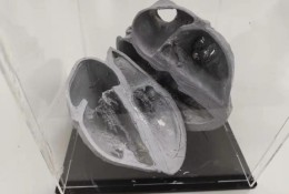 个性化的医学模型制作