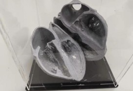 个性化的医学模型制作